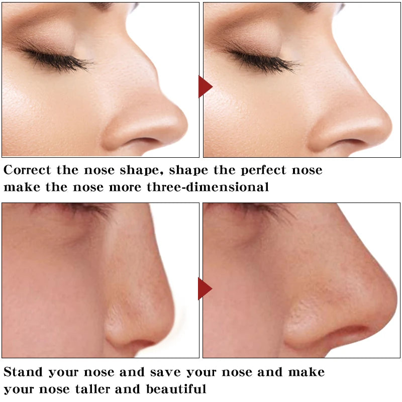 Nose Up Heighten Rhinoplasty oil Nose Up Heighten Rhinoplasty Nasal Bone Remodeling Pure Natural Care Thin Smaller nose