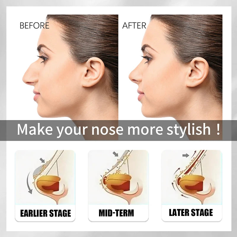 Nose Up Heighten Rhinoplasty oil Nose Up Heighten Rhinoplasty Nasal Bone Remodeling Pure Natural Care Thin Smaller nose